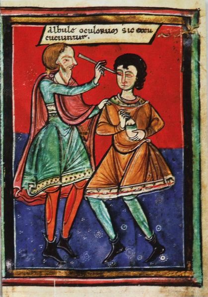 Operace oka na konci 12. století